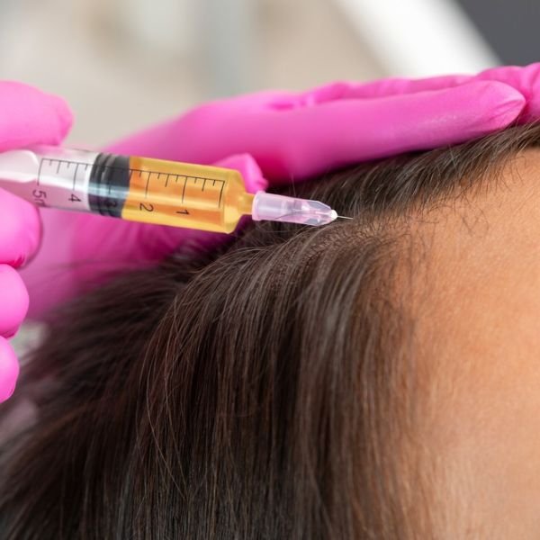 Stem Cell Injections for Hair Growth