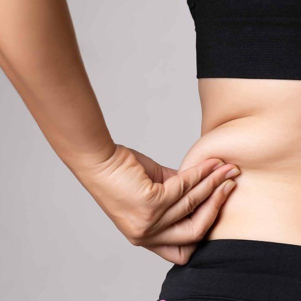 Tummy Tuck (Abdominoplasty)