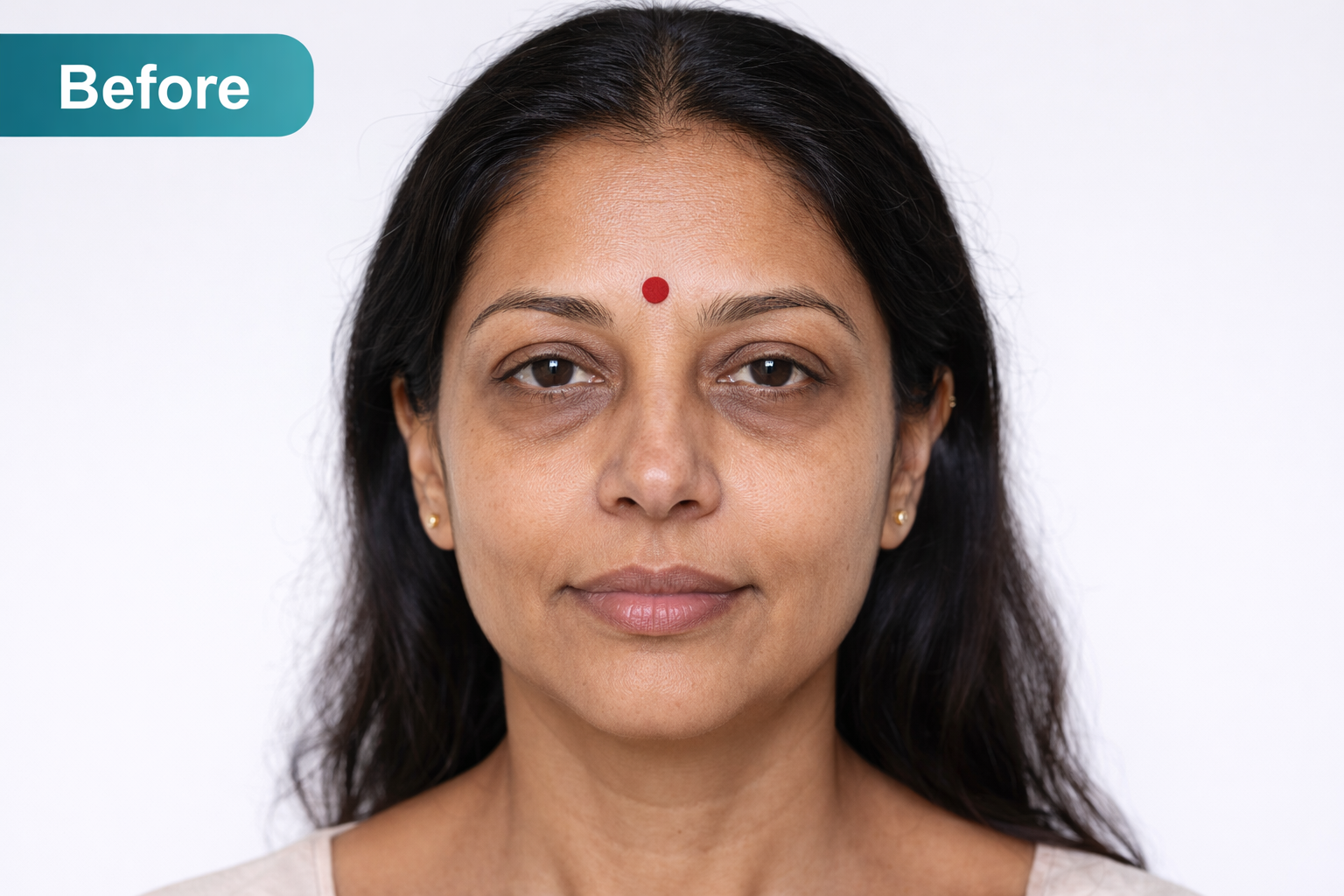 Aesthetic Plastic Surgery Before