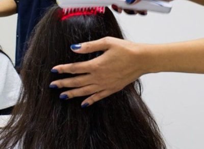 LASER Hair Growth Therapy