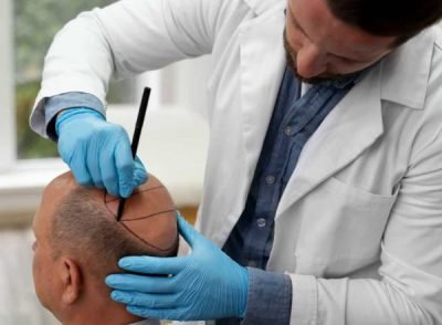 Hair Care & Hair Transplant