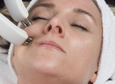 Facelift (Minimally Invasive Techniques)