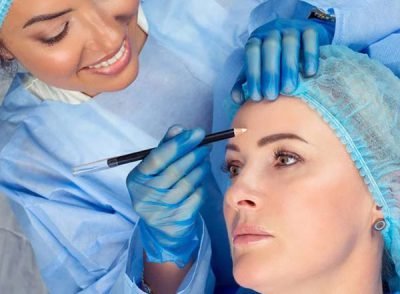 Forehead Lift