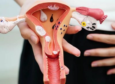 Hymenoplasty