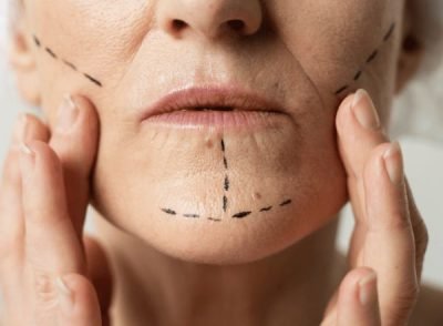 Post Trauma Reconstruction