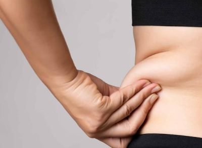 Tummy Tuck (Abdominoplasty)